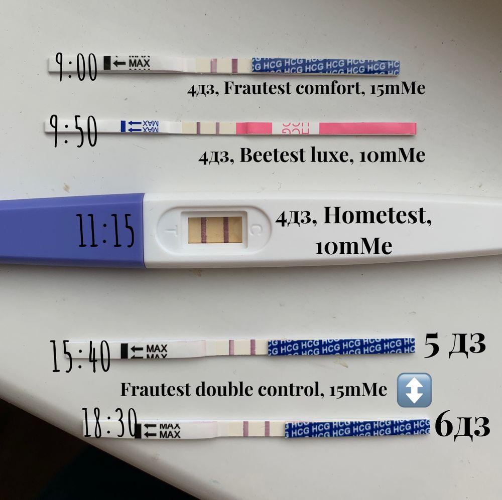 Когда у вас сравнялись полосочки? — 28 ответов | форум Babyblog