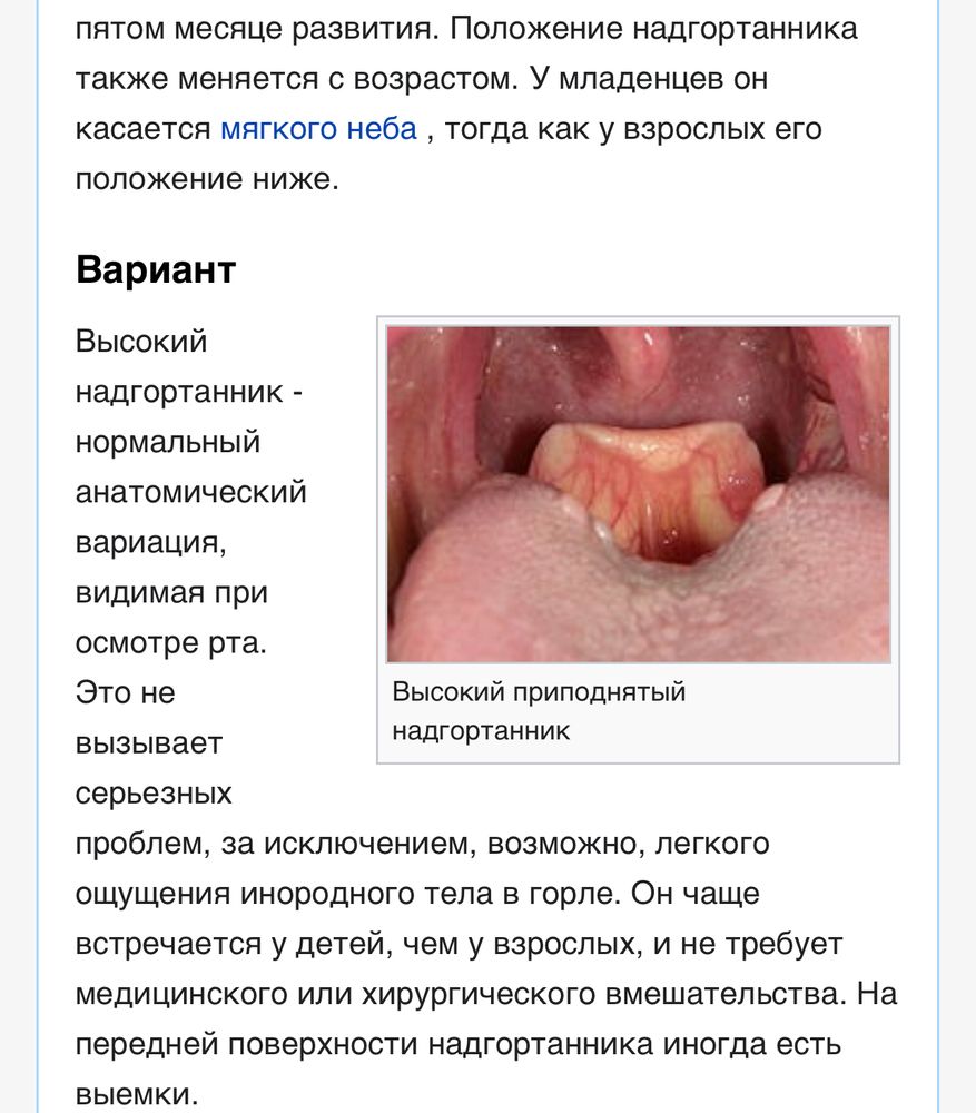 Эпиглоттит у детей - признаки, причины, симптомы, лечение и профилактика - geolocators.ru