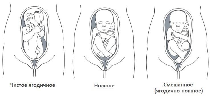 Как определить расположение ребенка самостоятельно