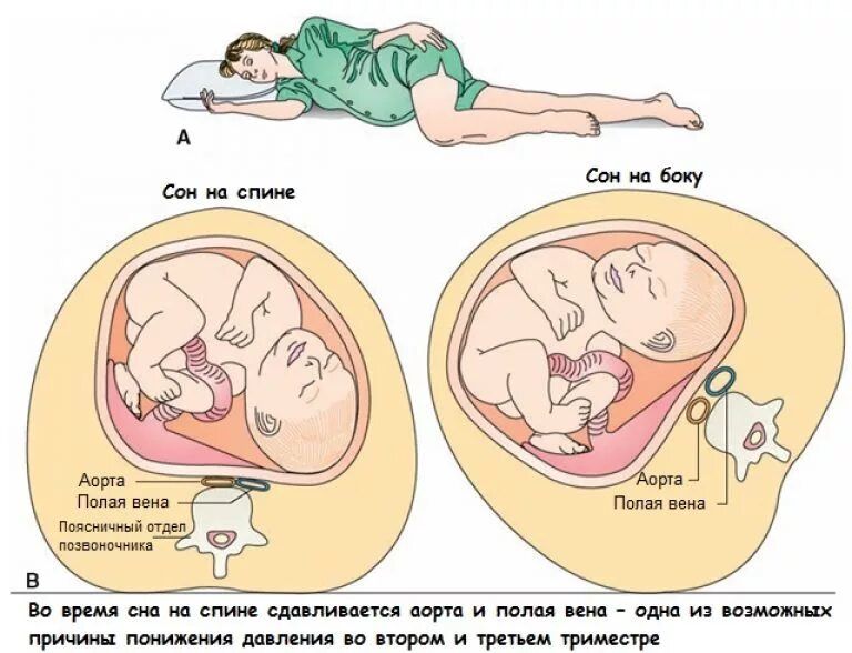 Высокий пульс и низкое давление одновременно: причины, что делать, лечение