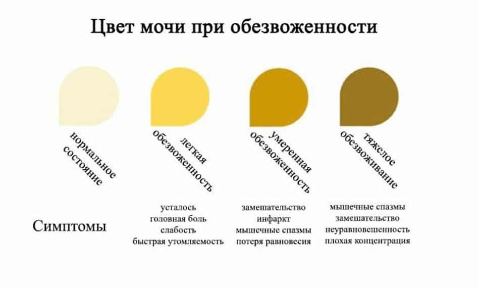 Изменение цвета и запаха мочи: причины и лечение