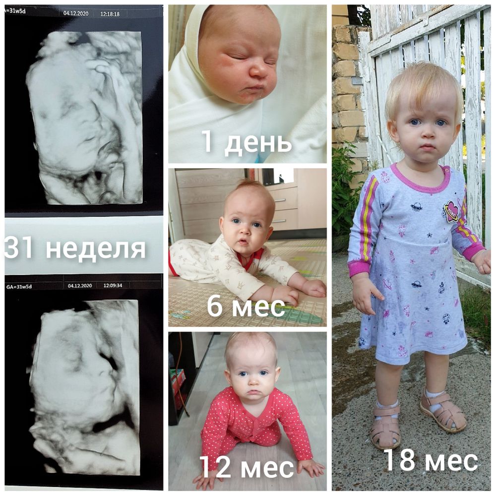 3Д узи в 31 неделю. — 21 ответов | форум Babyblog