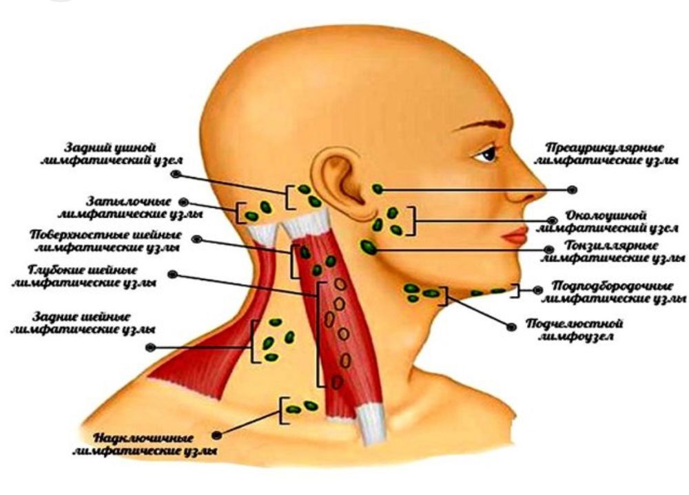 Воспалились лимфоузлы на шее расположение схема