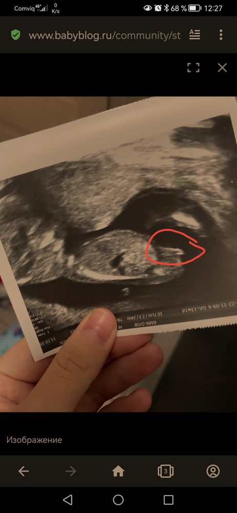 Изображение