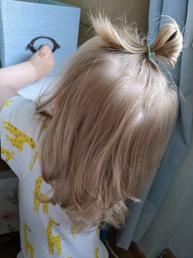 Плохо растут волосы у ребенка