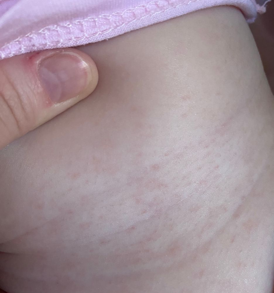 Ребенок прт температуре не берет грудь — 38 ответов | форум Babyblog
