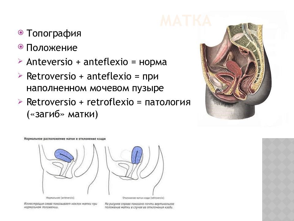 Матка расположена. Антеверзио и антефлексио матки. Антеверсио положение матки что это. Положение матки anteflexio anteversio. Anteversio anteflexio матки что это.