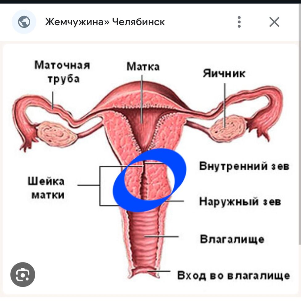 Шприцом из презерватива — 74 ответов | форум Babyblog