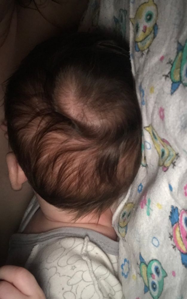 Почему появляются залысины на голове у малышей? | Читай в блоге sauna-chelyabinsk.ru
