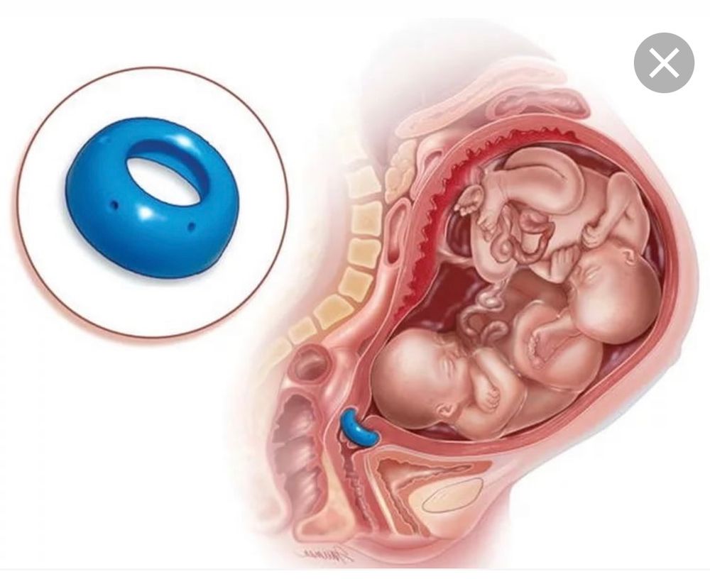 оргазм и гипертонус матки при беременности фото 82