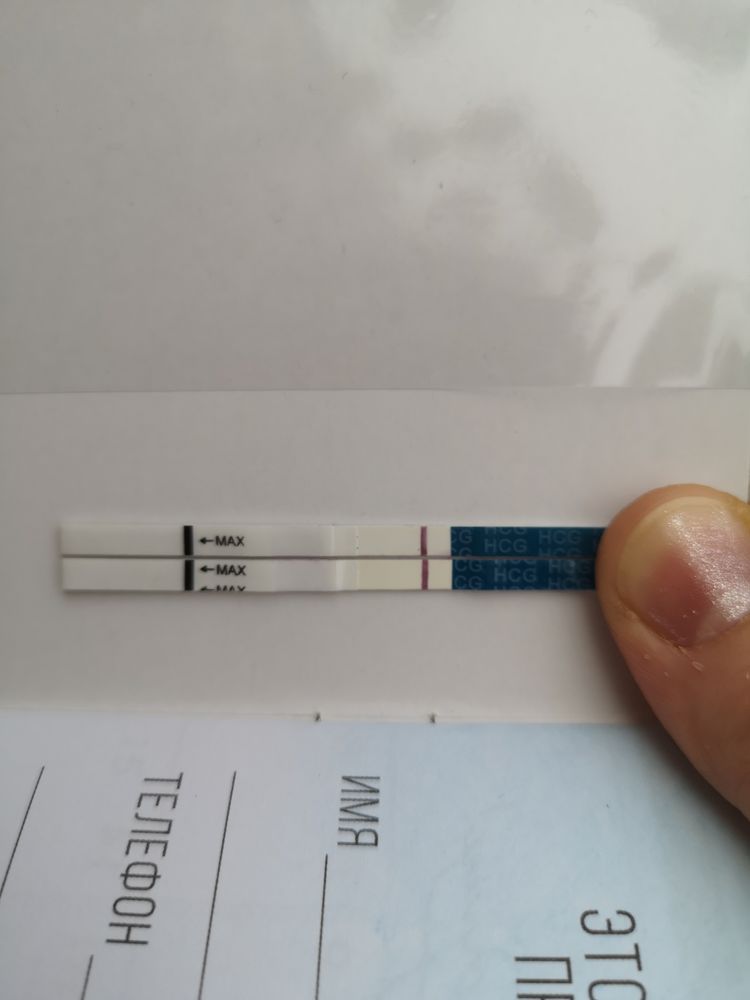 Менструация темно коричневая. 2 дня месячные потом закончились. Эндометриоз и менструационный цикл. Выделения после кесарева сечения. 2 дня месячные потом закончились.