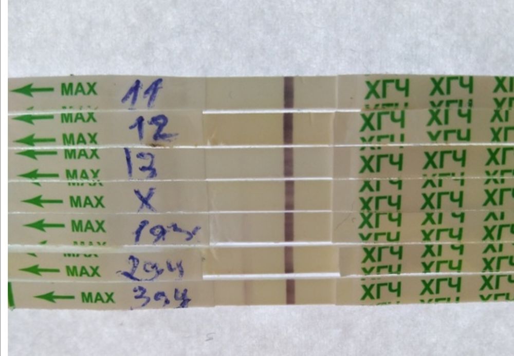 Хгч при внематочной. Тест на ХГЧ. Внематочная беременность тест ХГЧ. ХГЧ В крови и на полоске. Тест ХГЧ при внематочной беременности.