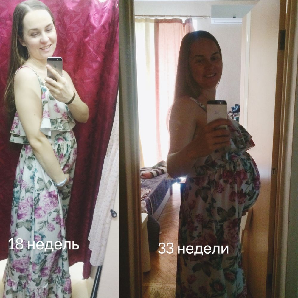 📝🌷35 неделя беременности 🤰💐 +фото — 25 ответов | форум Babyblog