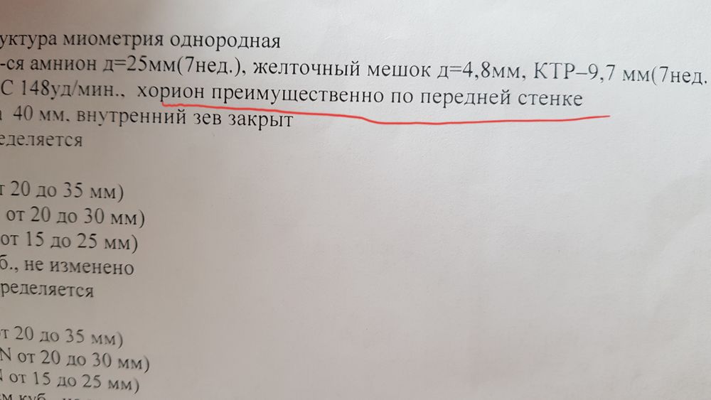 Крепление хориона по задней стенке