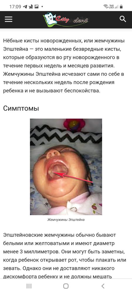 Стоматит у детей - БЛОГ детской стоматологии УткинЗуб в Москве