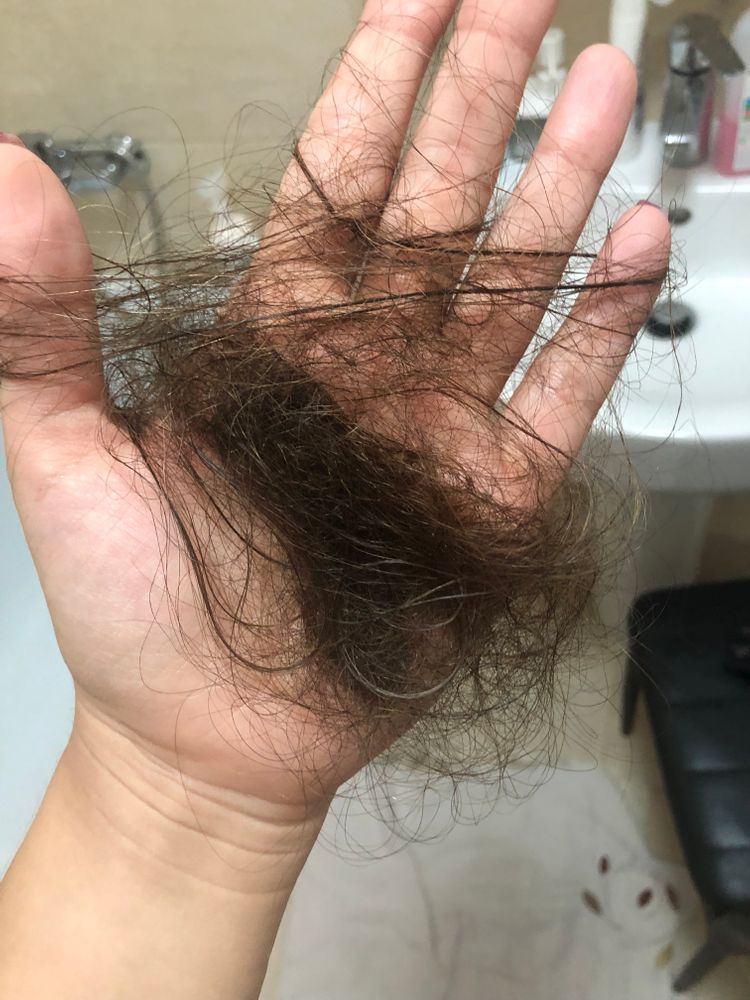 Что делать, если выпадают волосы - блог VIRTUS