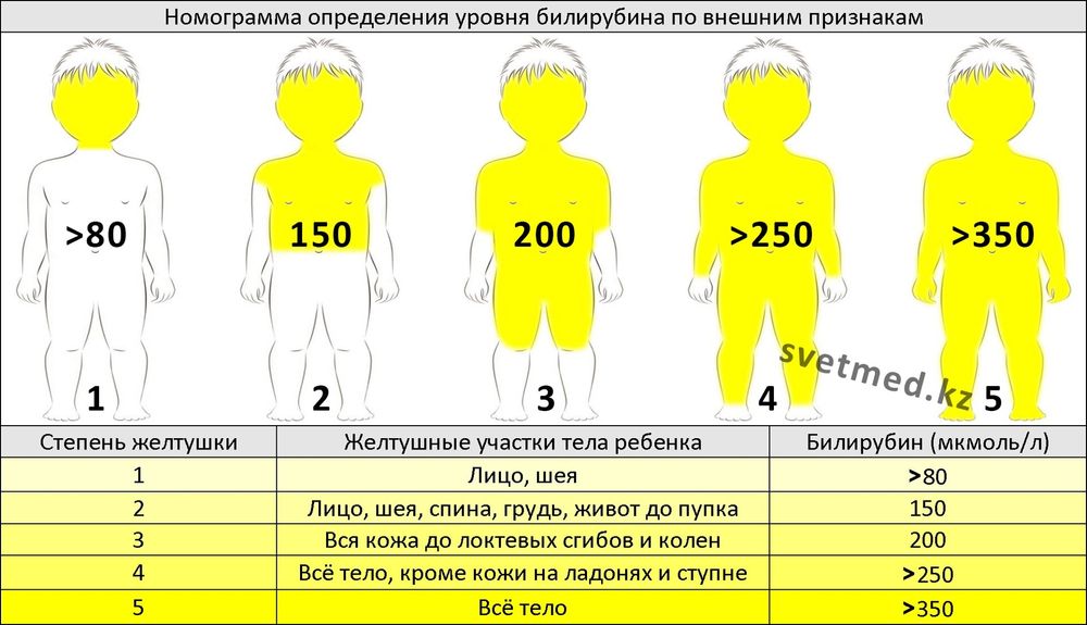 Норма билирубина у новорожденных