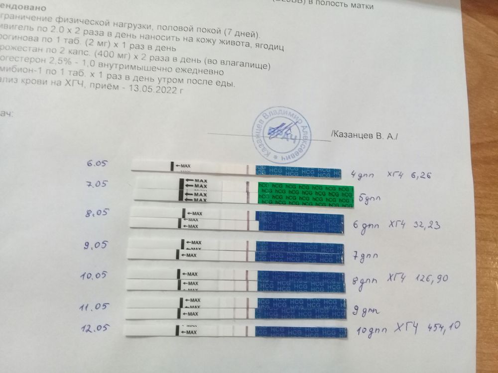 Криопротокол. 16 ДПП ХГЧ. ХГЧ на 21 ДПП.