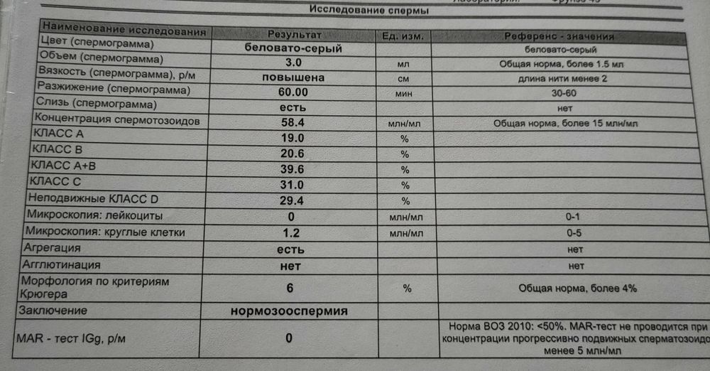 Спермограмма: исследование эякулята