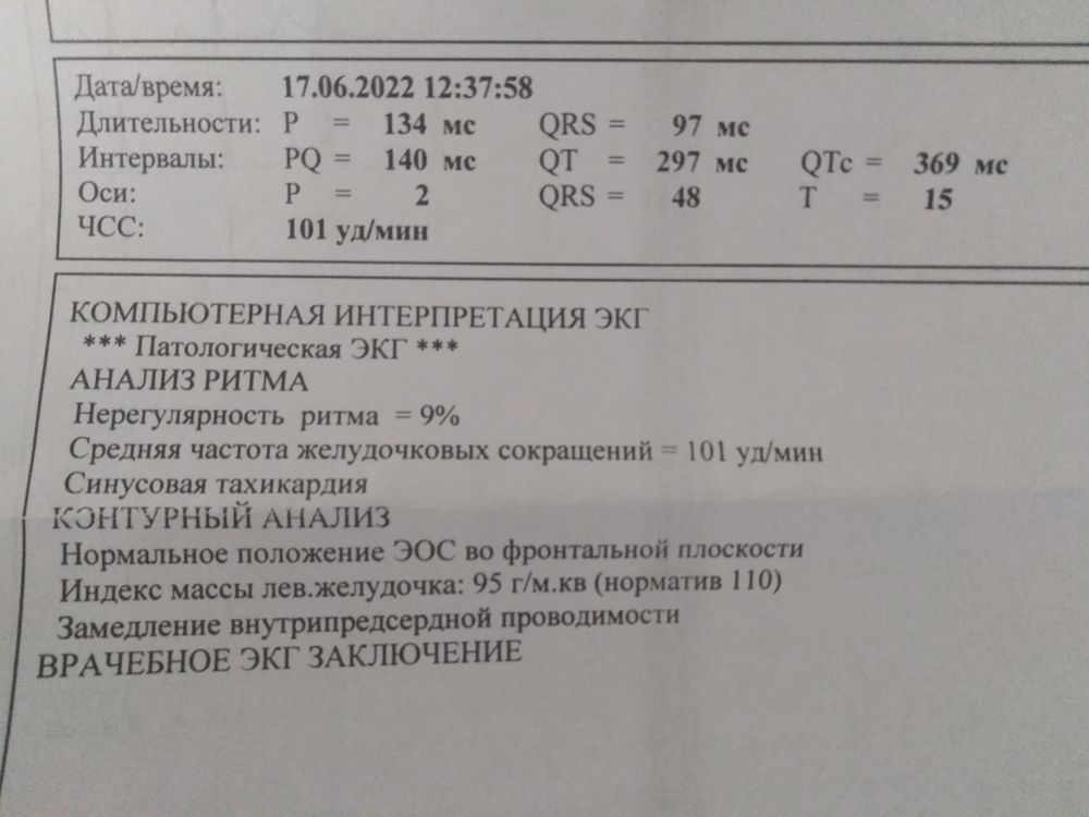 Мукополисахаридоз: орфанное заболевание в практике педиатра