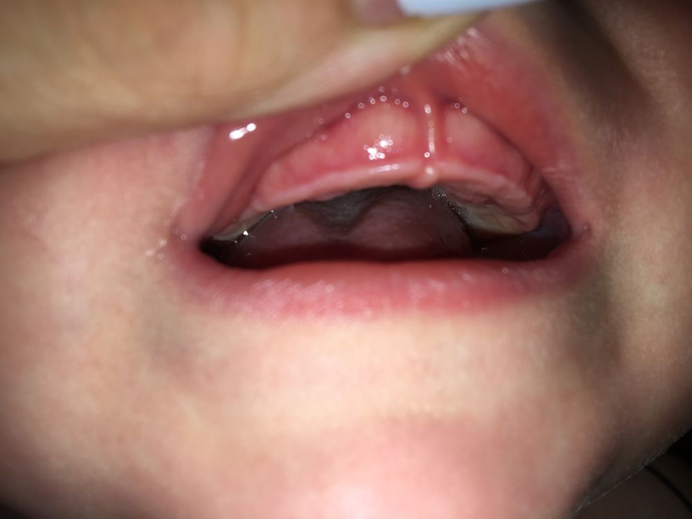 Прорезывание зубов у детей: что нужно знать родителям - Статьи - Стоматология «Эталон»