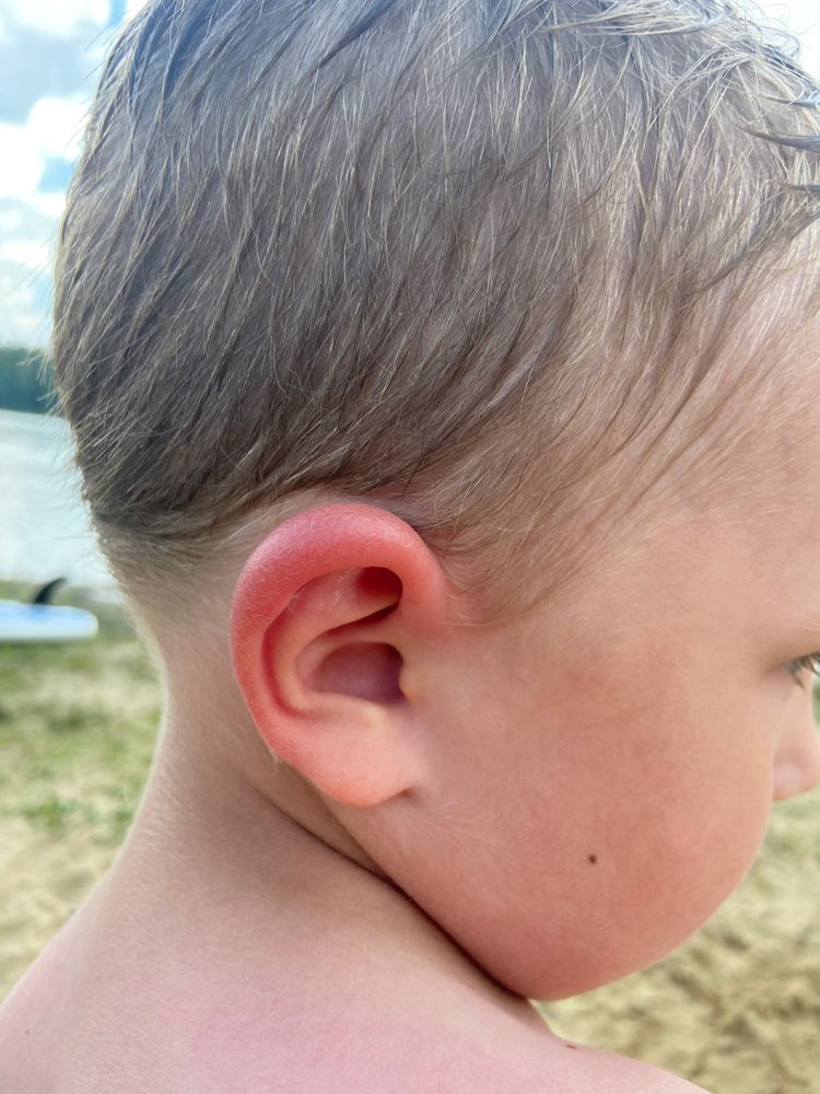 Боли в ушах: причины, разновидности, лечение