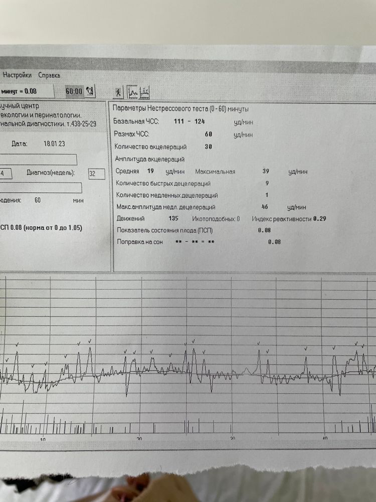 Показатели ктг норма