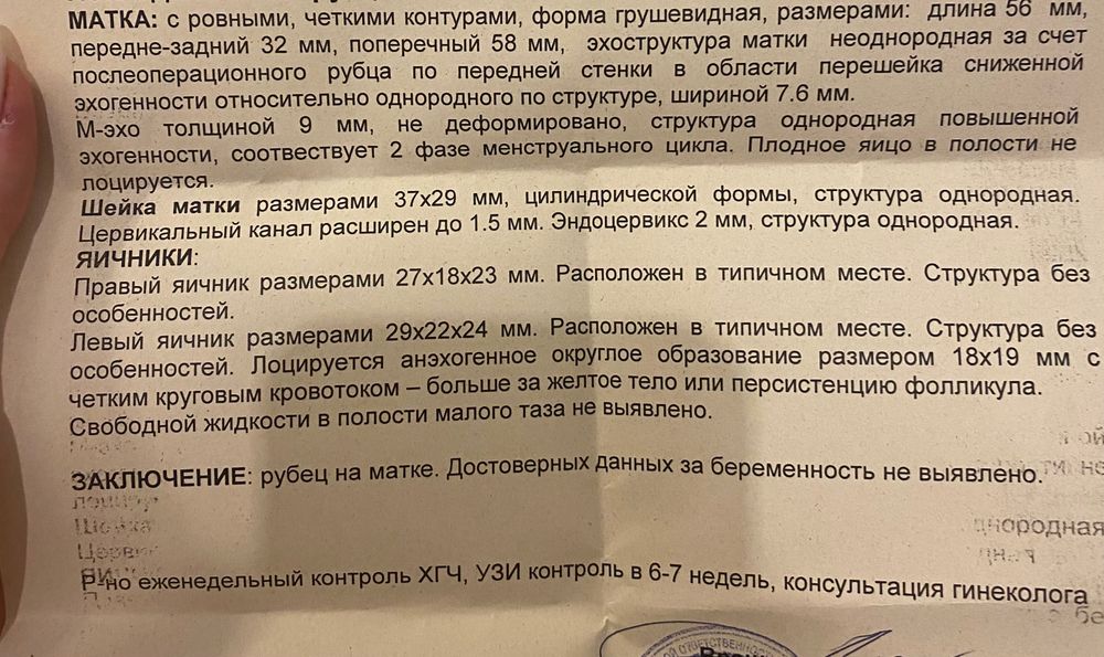 Все про овуляцию. Наиболее часто задаваемые вопросы