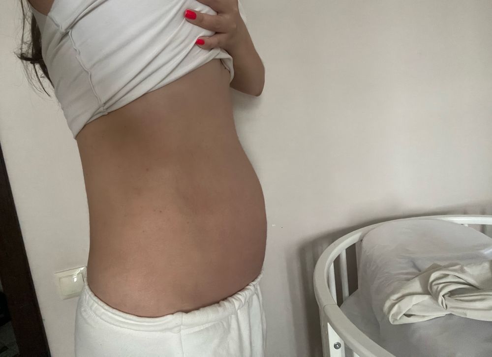 35 неделя беременности: узи плода на 35 неделе
