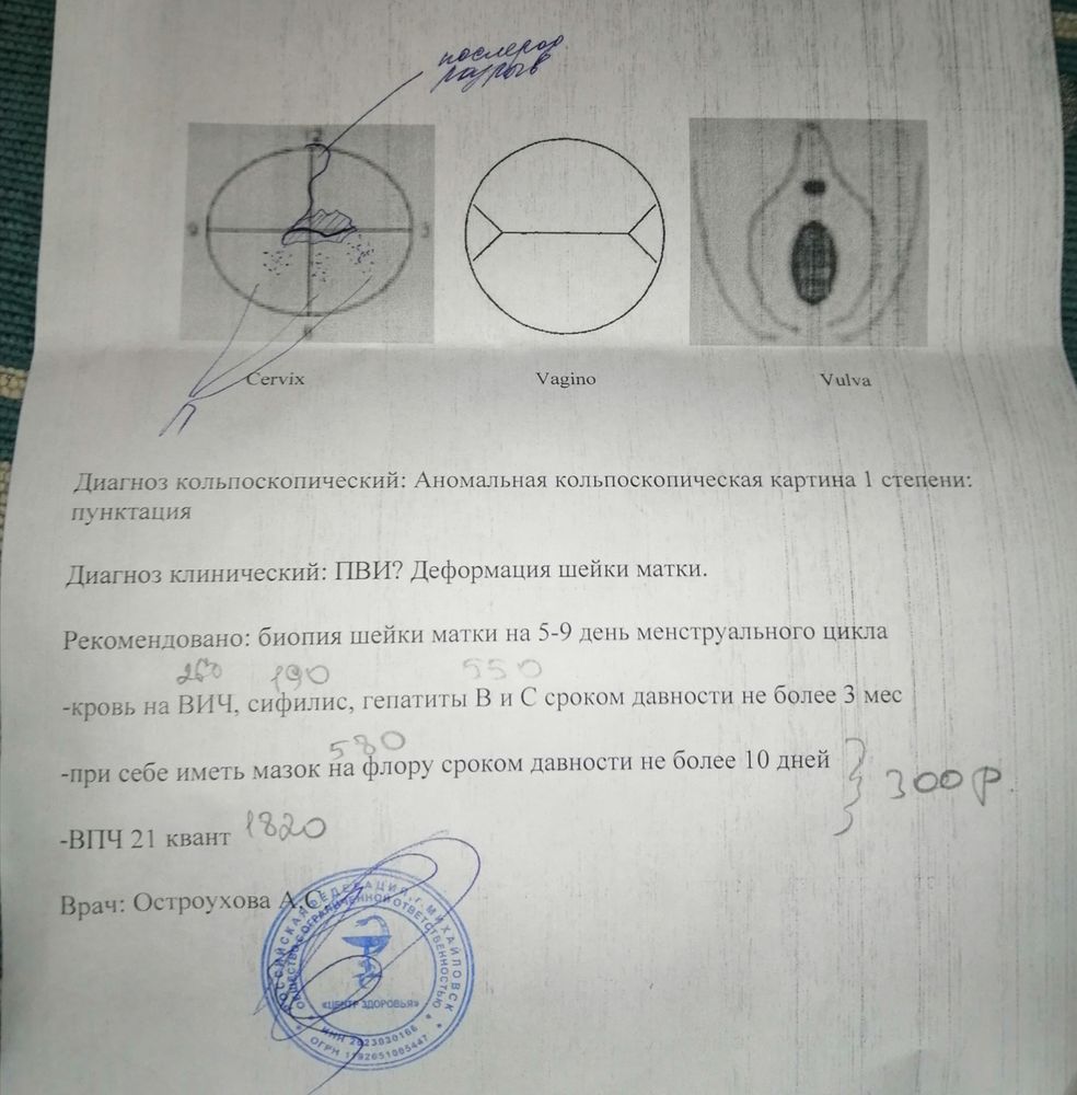 Кольпоскопическая картина 1 степени