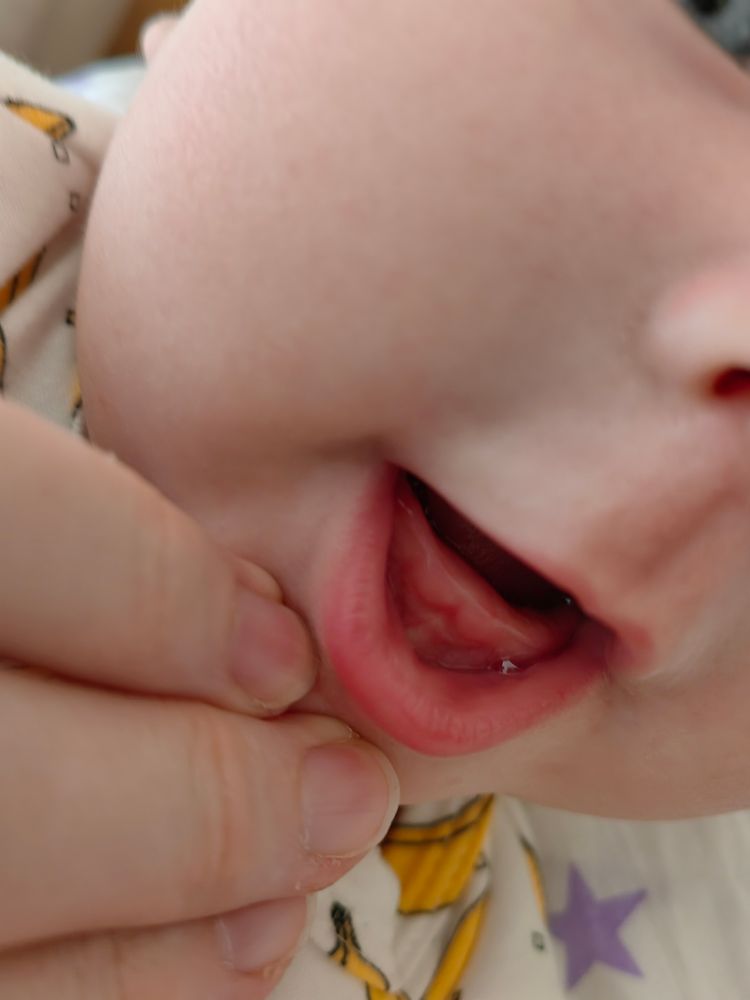 Как режутся молочные зубы у детей – схема и сроки появления первого зуба