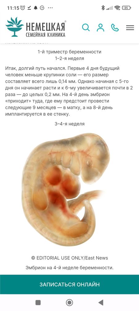 Подсадили эмбрион форум. Развитие эмбриона по неделям. Размер эмбриона на 6 неделе.