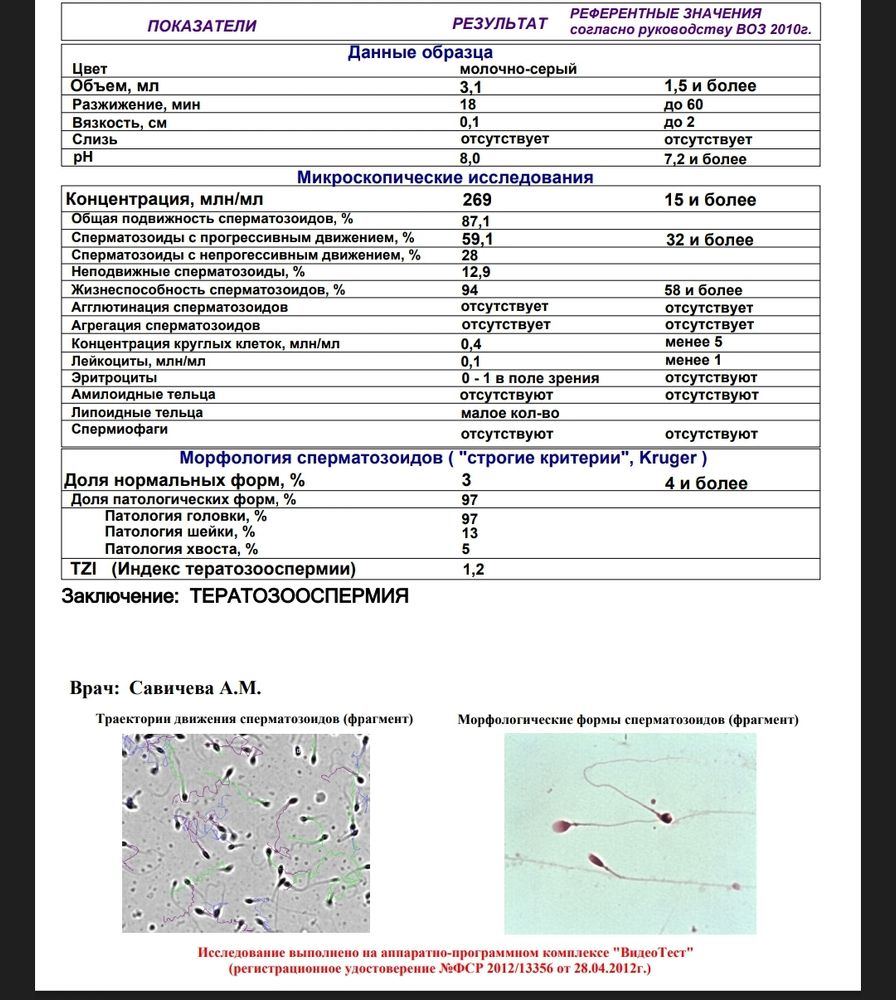 Схема лечения тератозооспермии форум