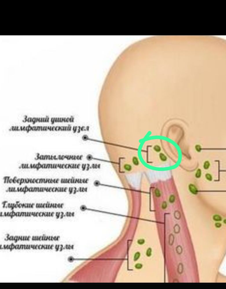 Увеличение лимфатических узлов у детей