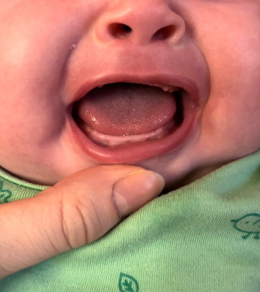 девочки mouth 