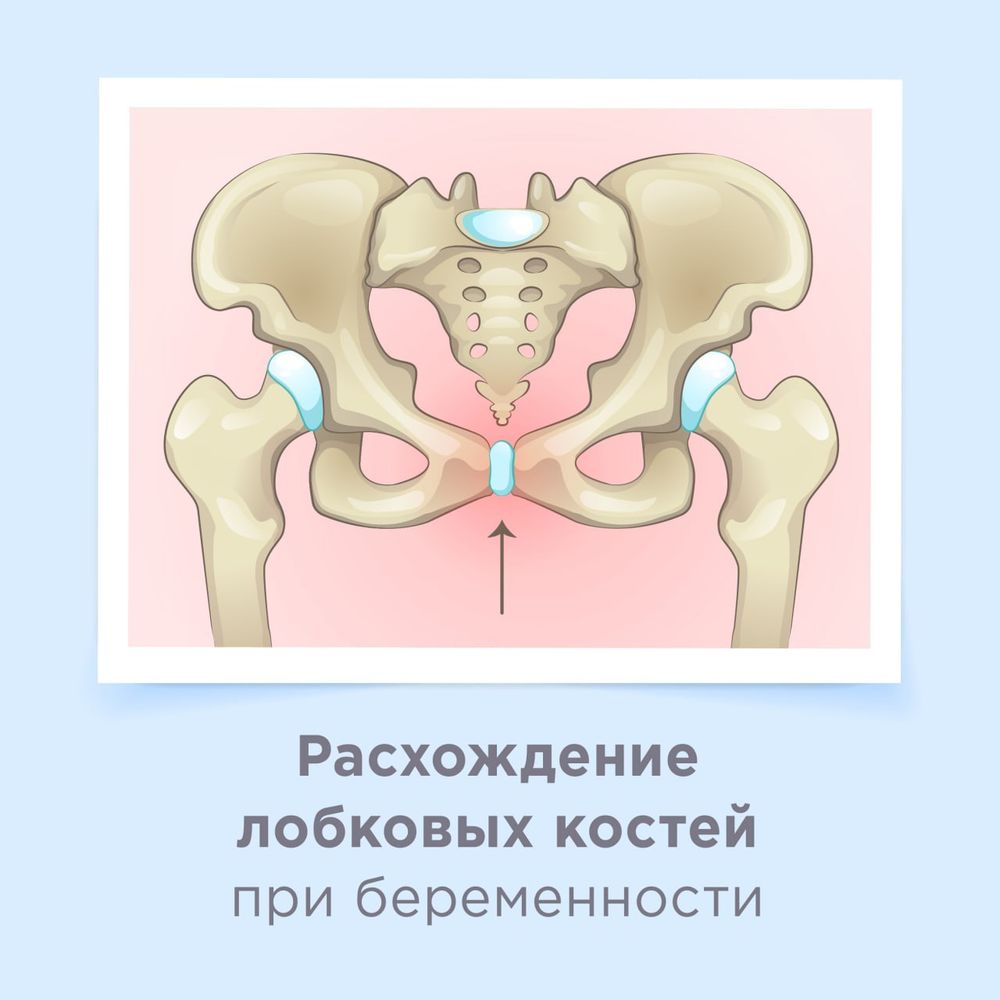 Фото Лобковой Кости