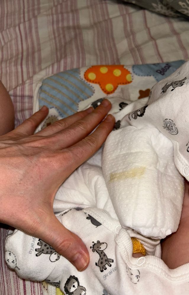 Писи маленьких" Желтые выделения у малыша из писи — 7 ответов | форум Babyblog