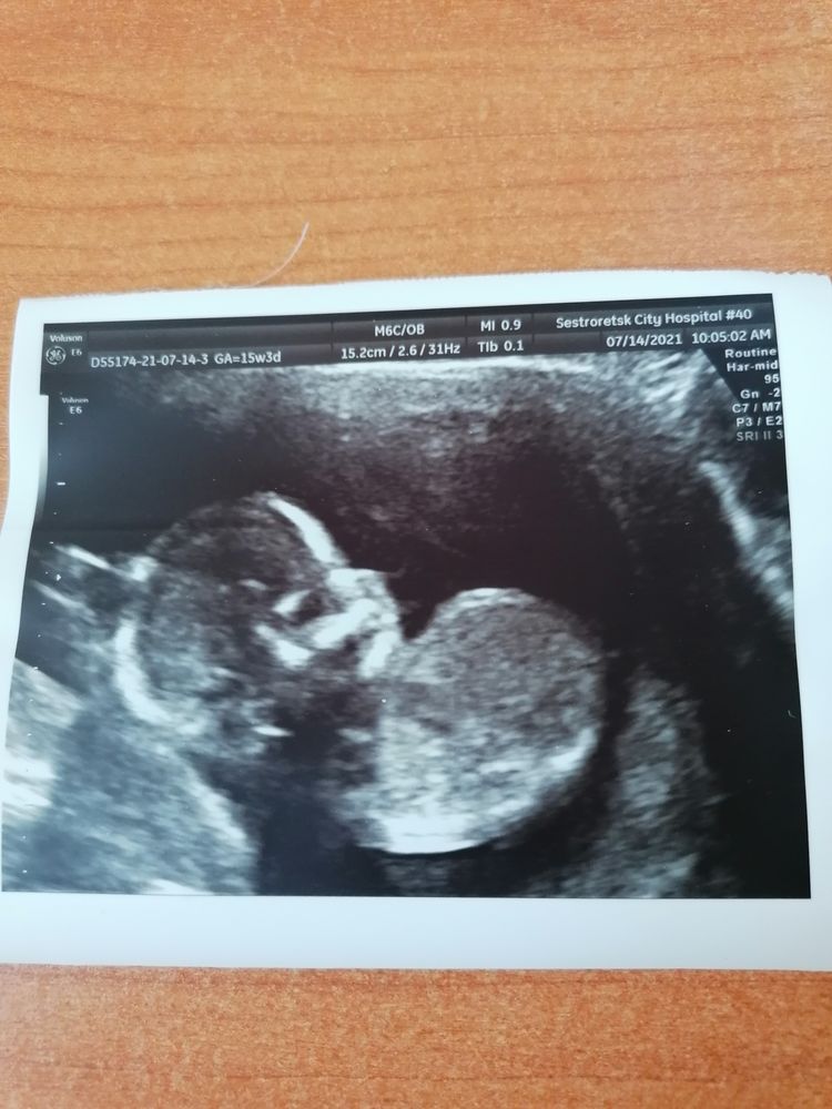 Сходила на узи. — 6 ответов | форум Babyblog