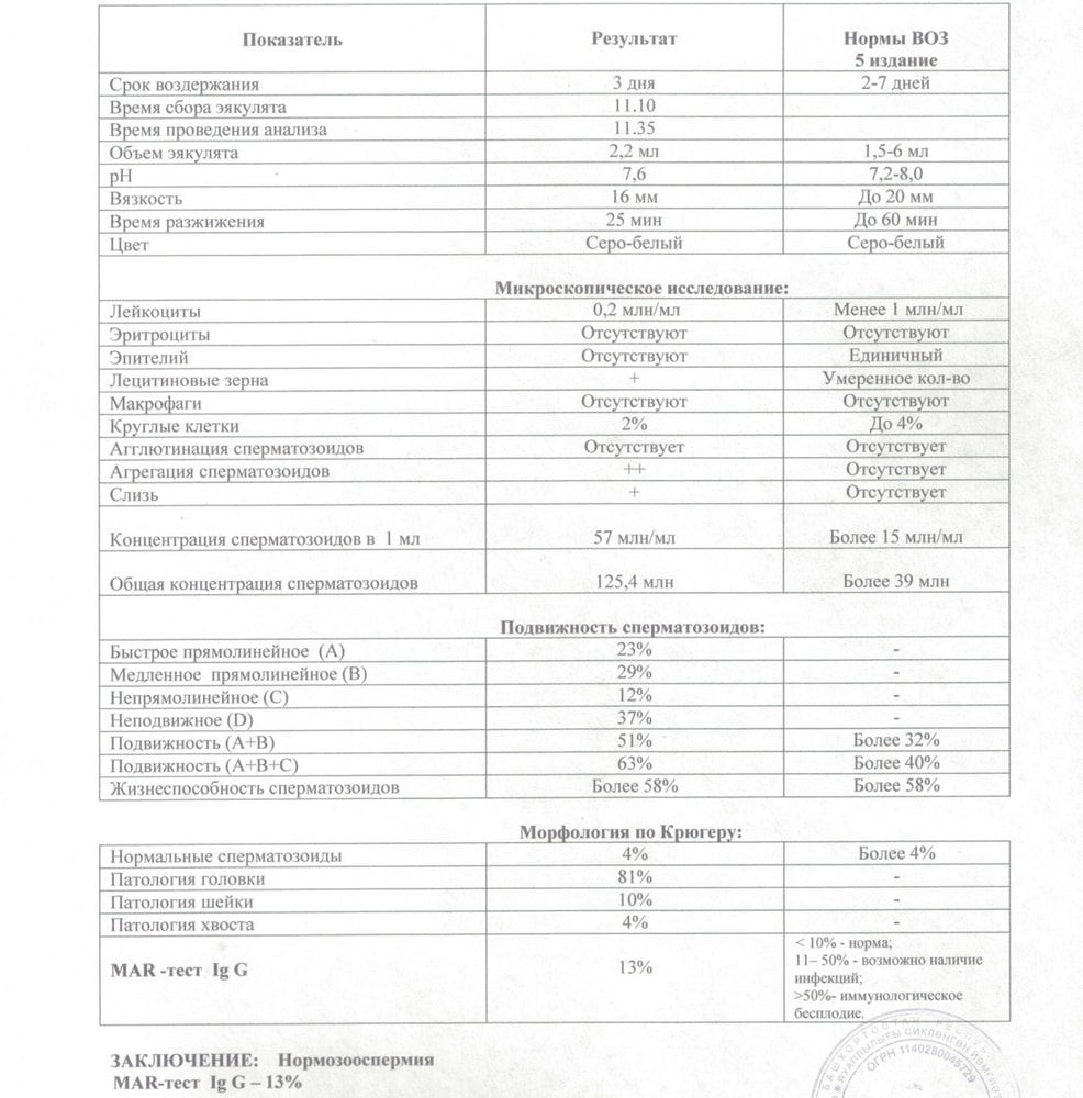 Оны автобуста сипалап жүр, бірақ ол байқамайды.